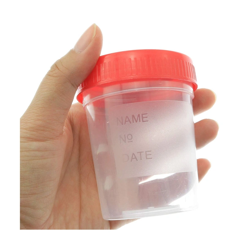 Disposable Medical PP 120ml Sterile Urine Specimen Cup Urine Container with Label